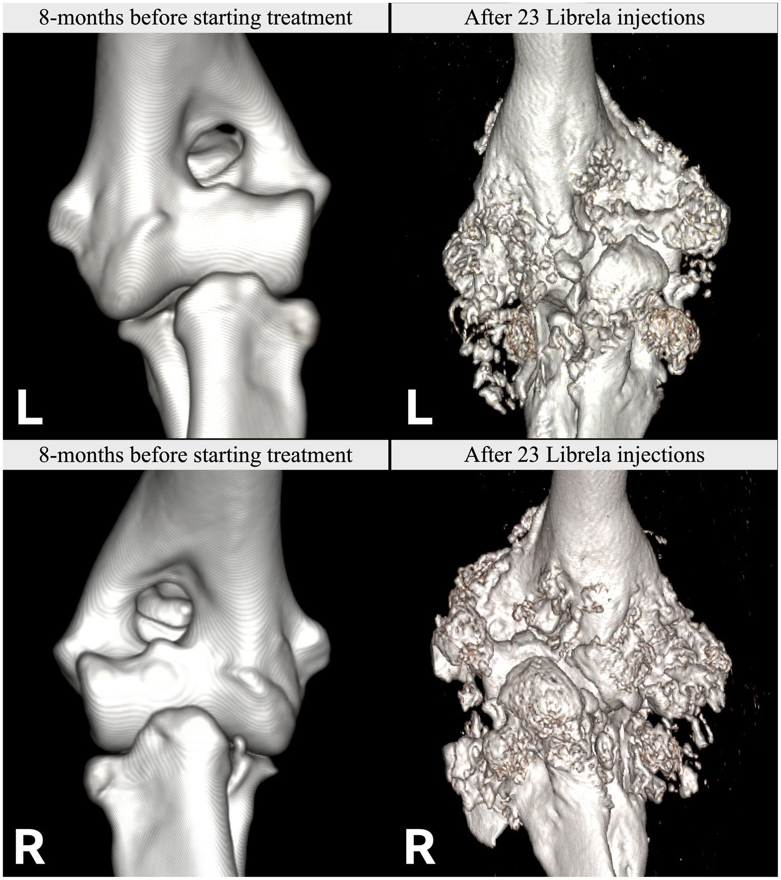 Beransa (Librela) Injections - Miracle pain drug or Risky Gamble?