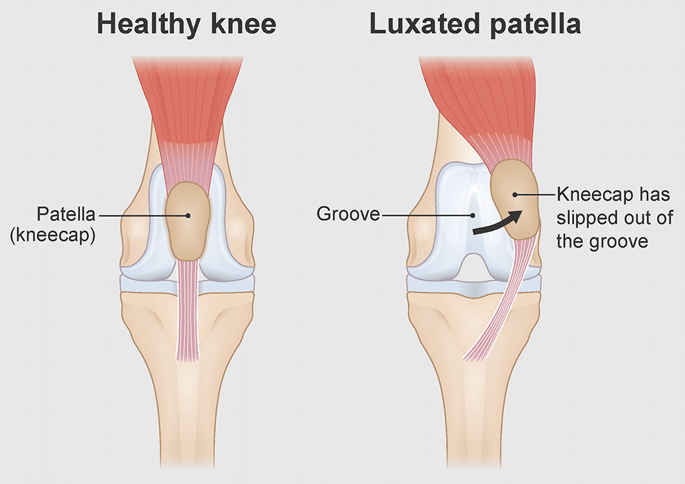 Luxating Patellas in Dogs